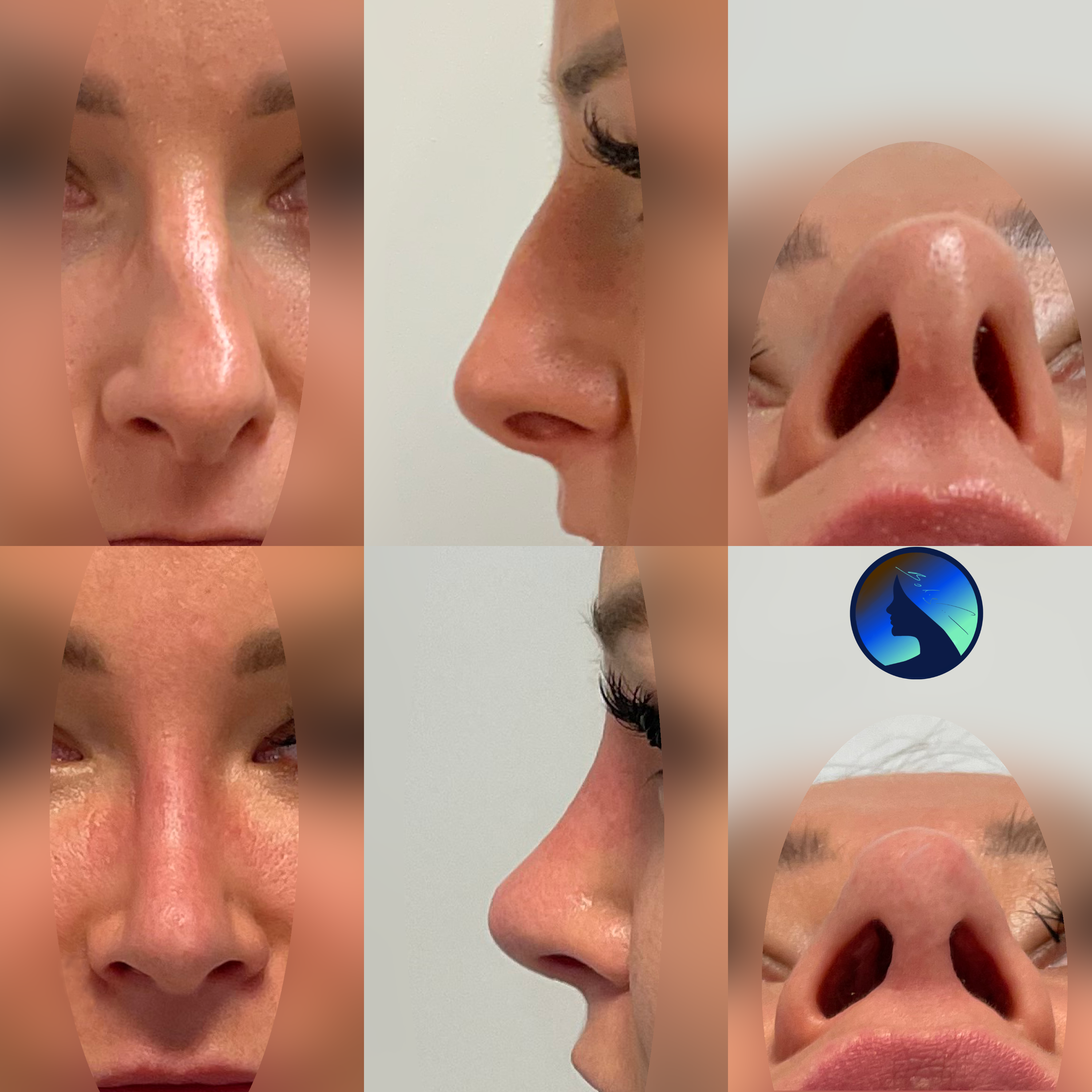 Niezwykle piękny nos