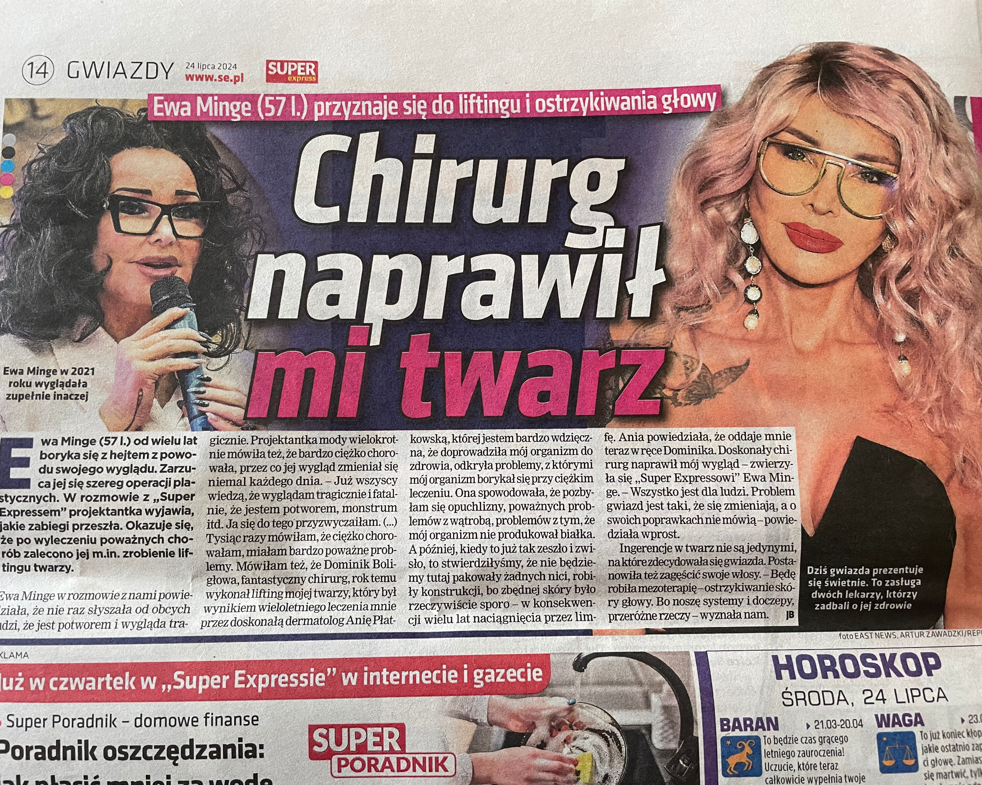 Chirurg naprawił mi twarz