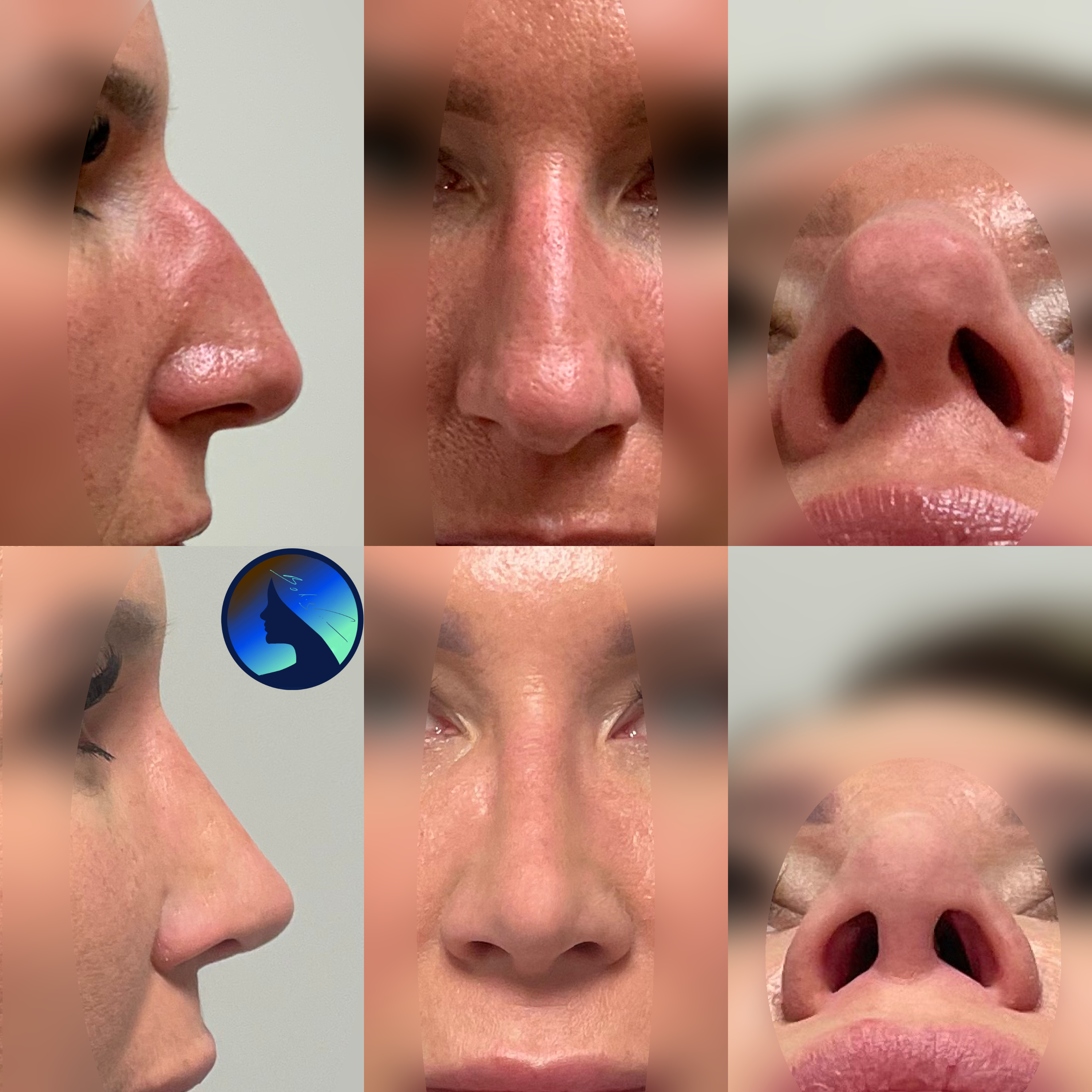 a beautiful classic nose