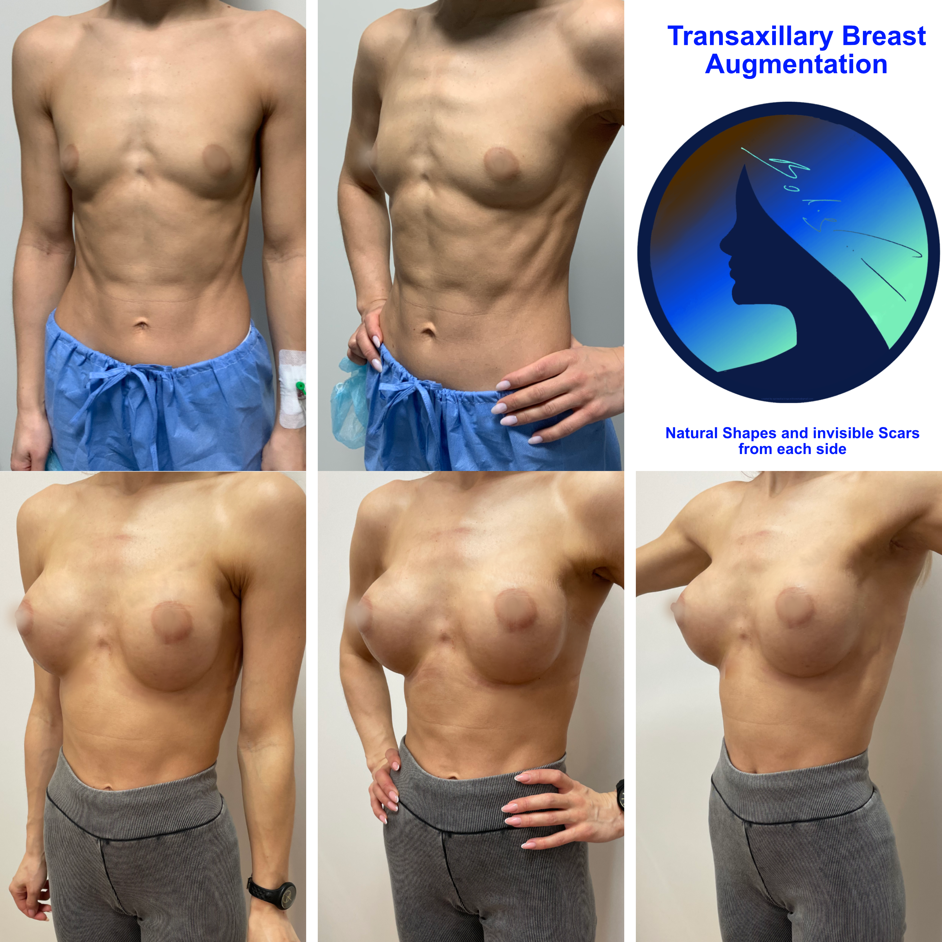 Endoscopic special 2