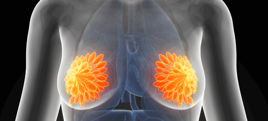 Czy lifting piersi bez implantów to dobra alternatywa? Porównanie technik Lifting piersi