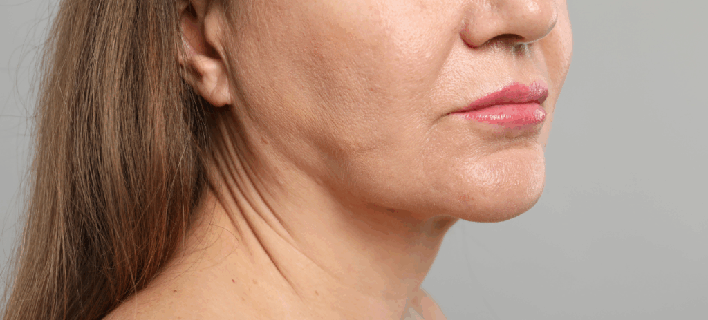 Korekta twarzy poprzez facelifting